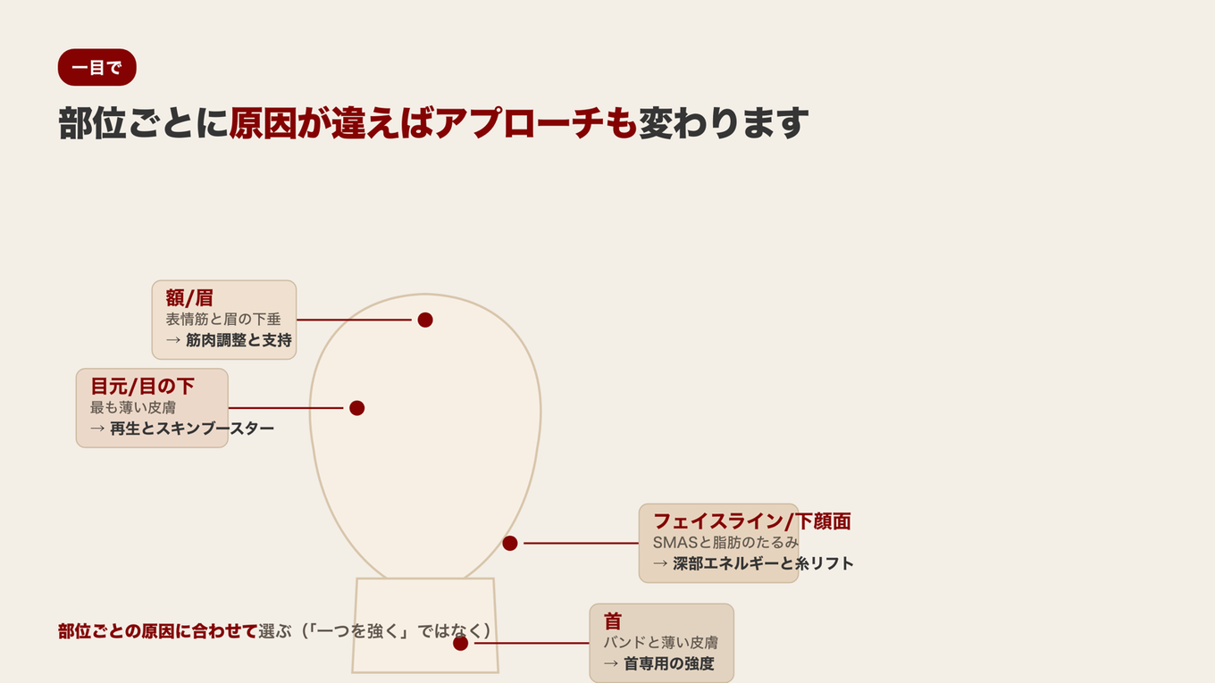 額は筋肉と眉、目元は薄い皮膚、フェイスラインはSMASと脂肪、首は筋肉バンドで部位ごとにたるみの原因とアプローチが異なる
