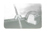 Soudure aluminothermique 1