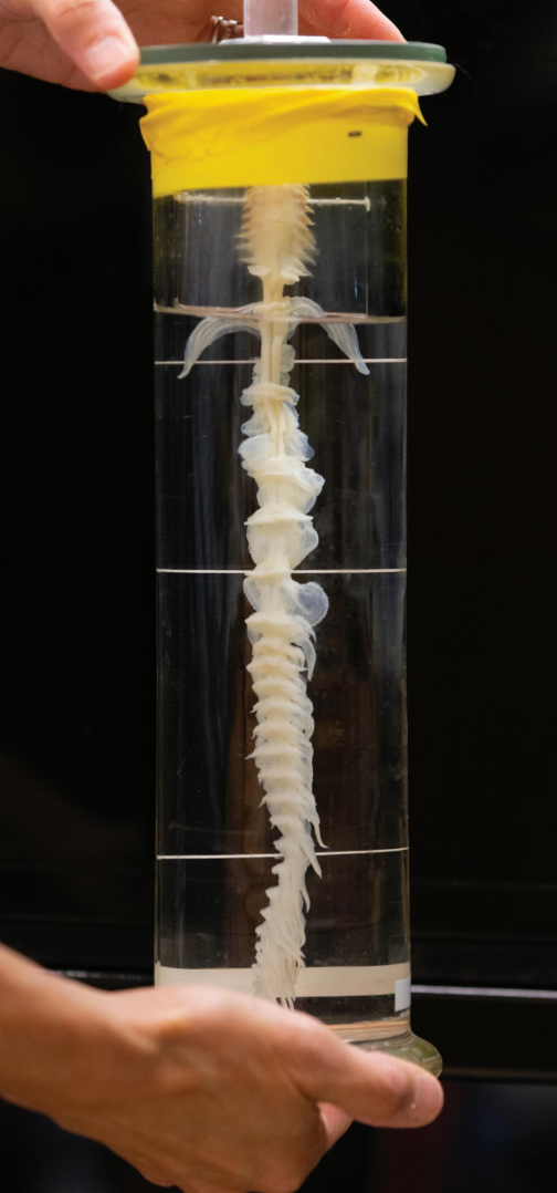vertebrae