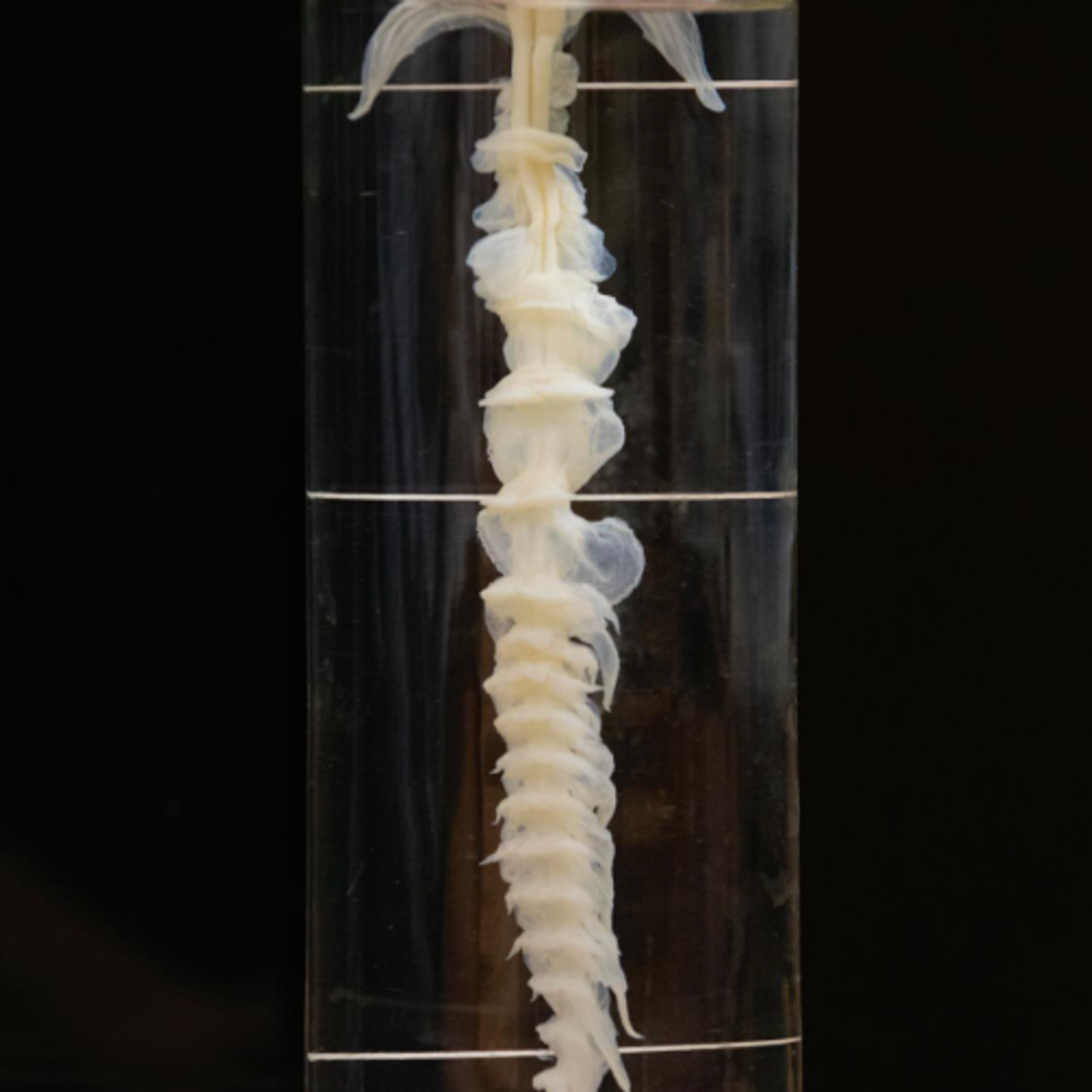 vertebrae