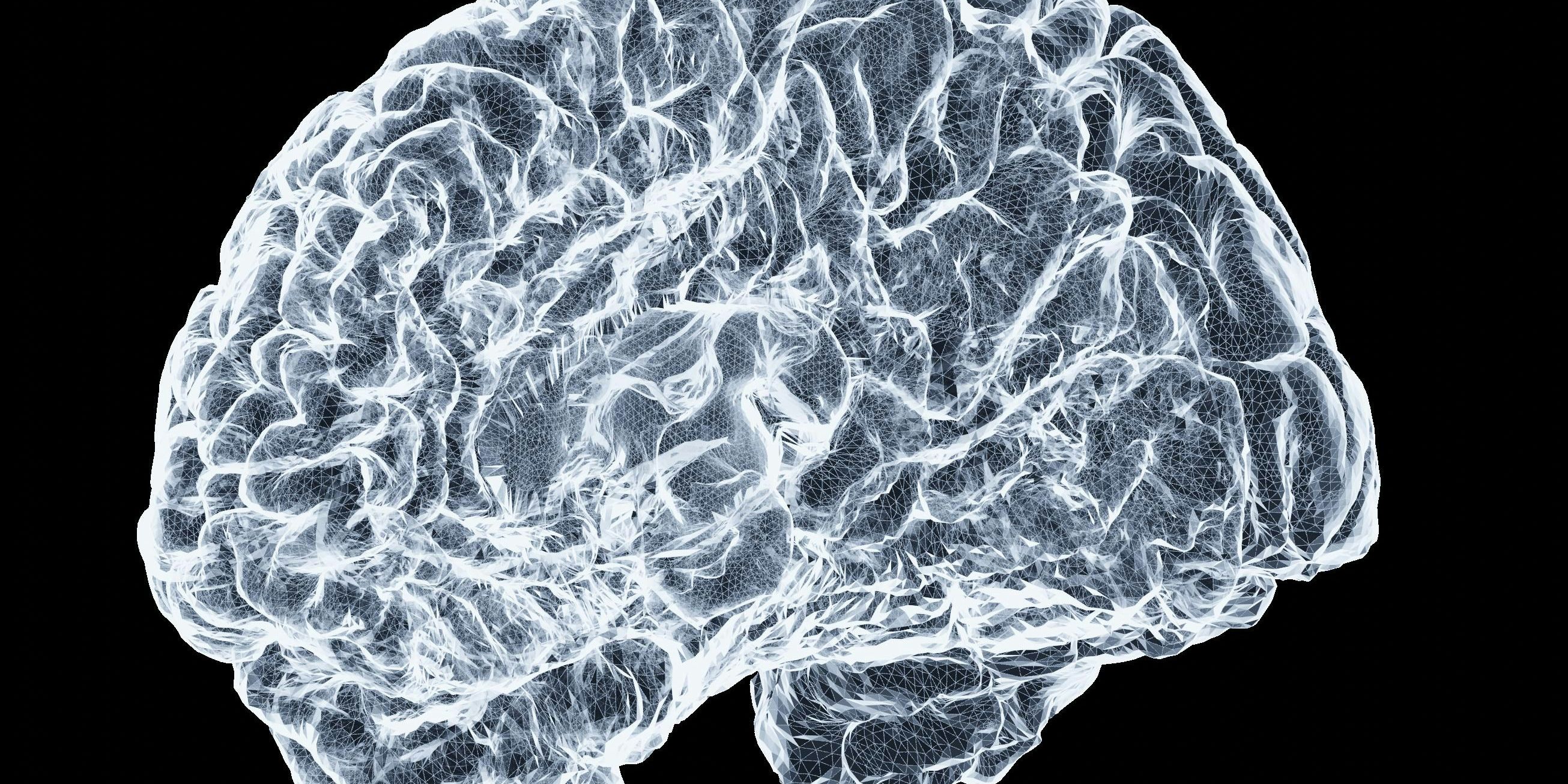 Black and white negative of a brain image