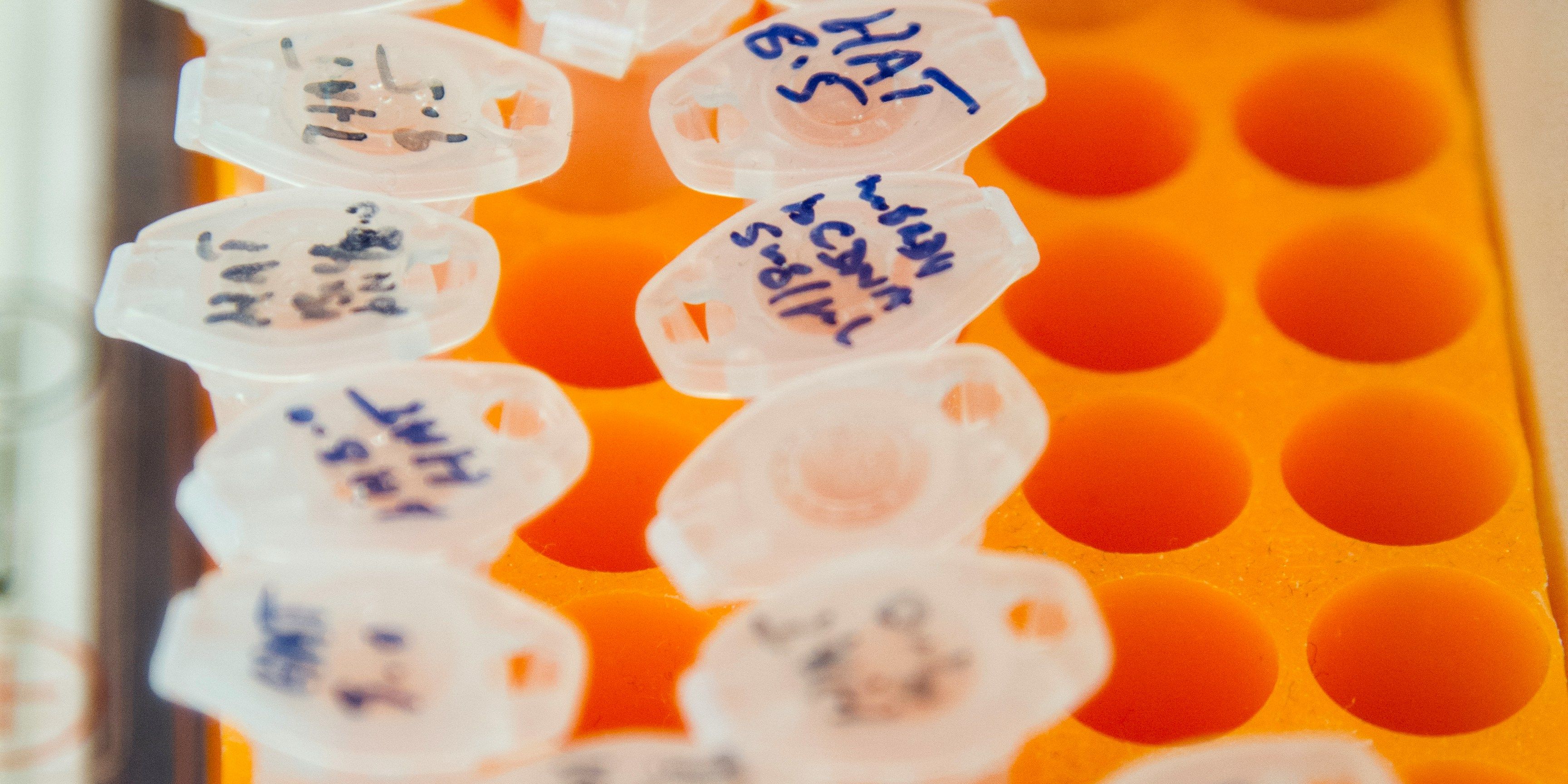eppendorf tubes in a tube rack