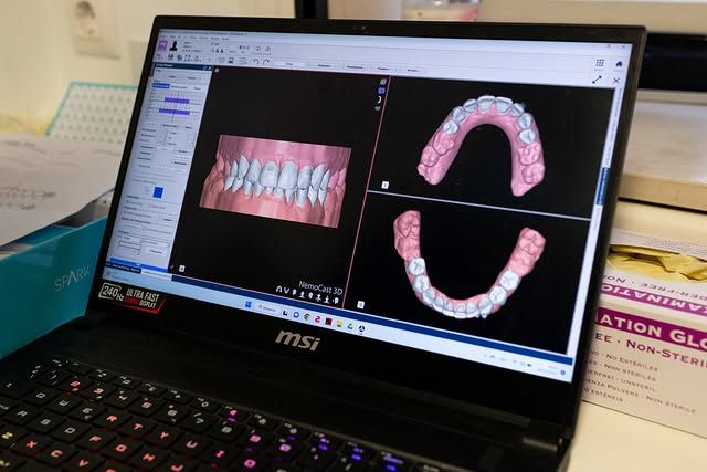 Protesis Dental