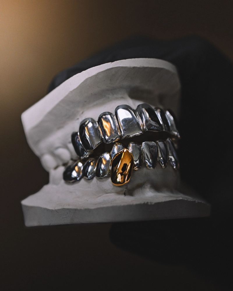 Détail or 18 carats sur un grillz pleine bouche