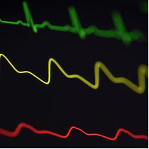 heart rhythm image