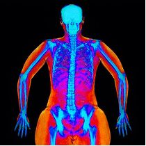 dexa image