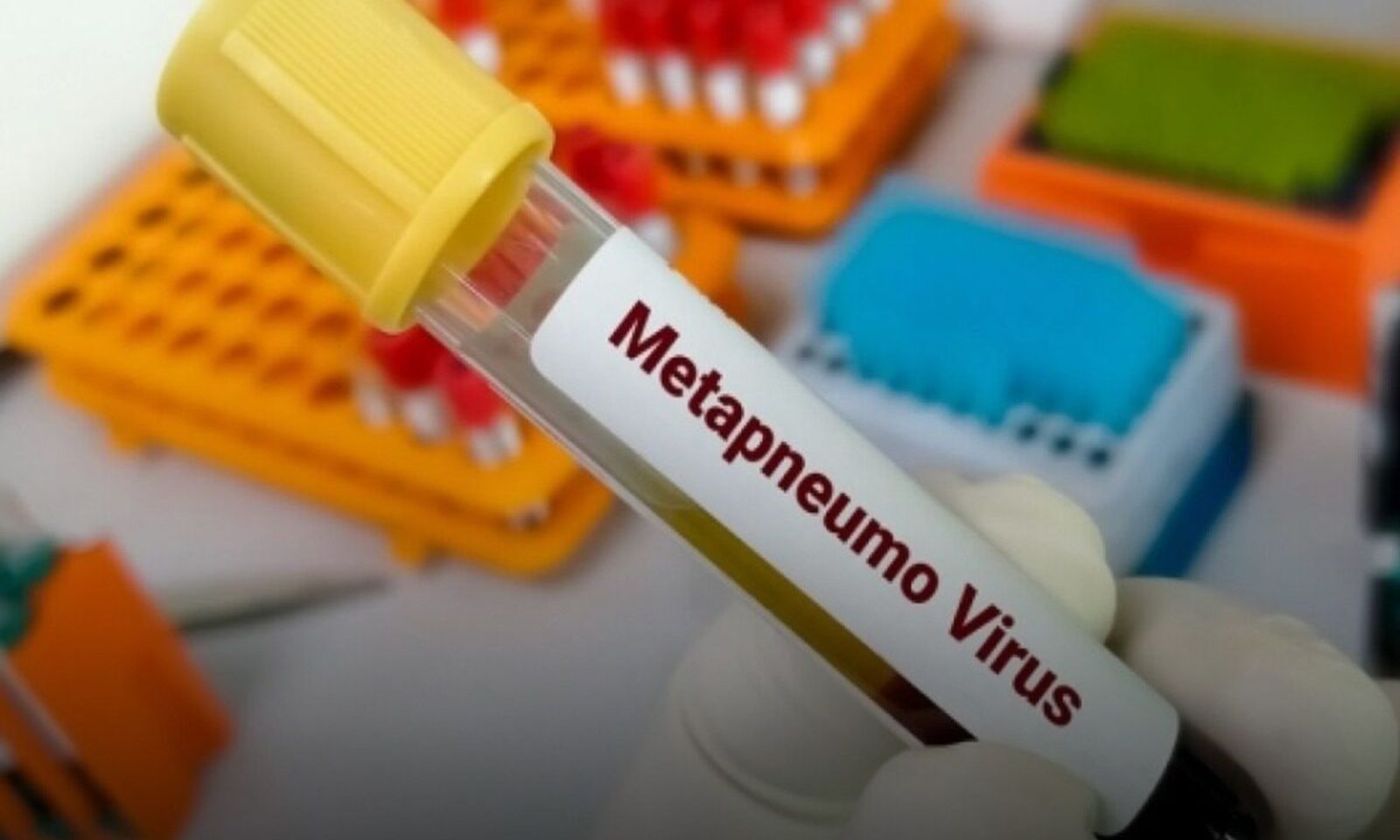 Бүгүнкү күндө дүйнө жүзүндө курч респиратордук вирустук инфекцияларга жана сасык тумоого чалдыккандардын сезондук жогорулоосу катталууда