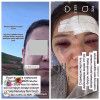 Кара-Кулжада келин күйөөсү сабаганын айтып милицияга кайрылды