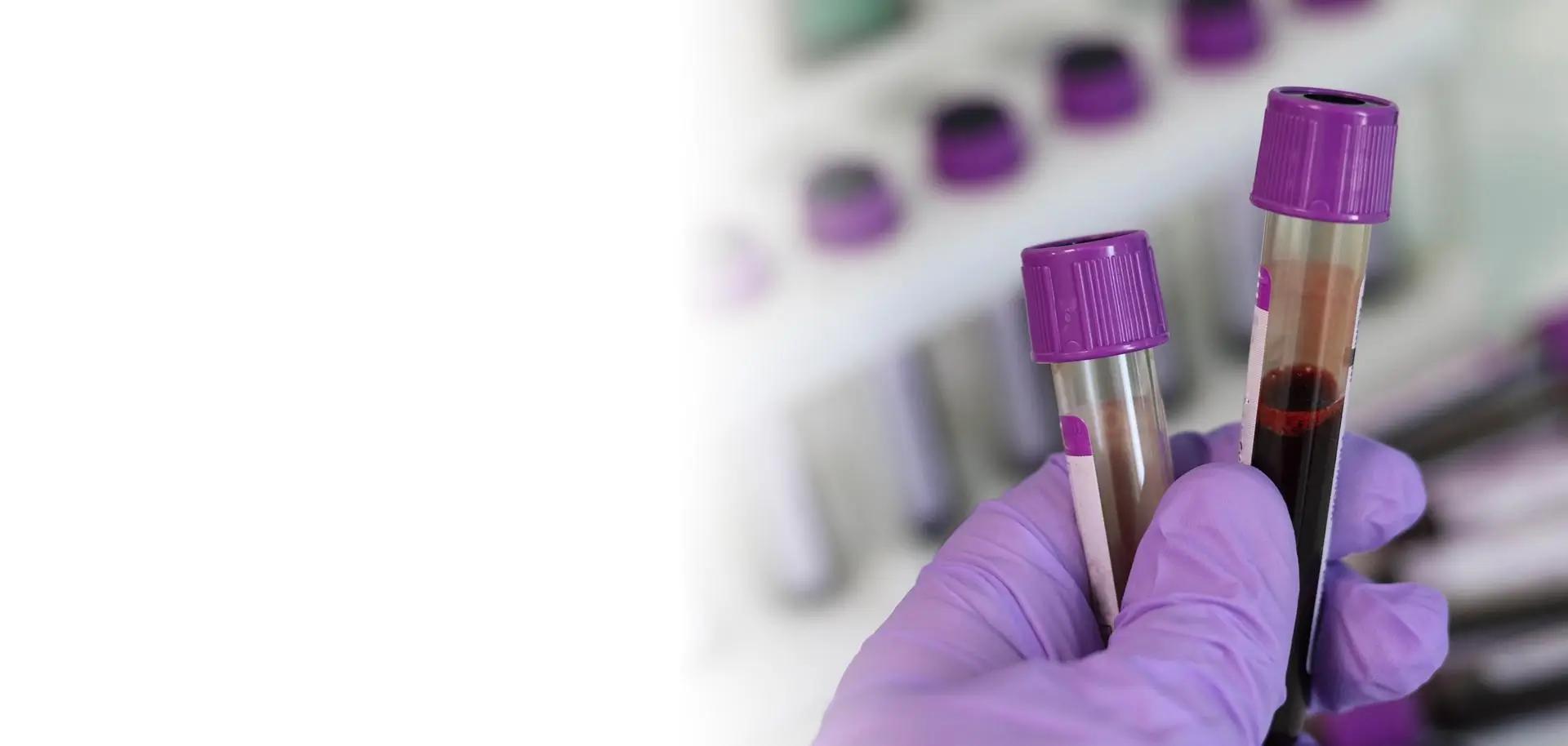Biotechfirma Hemostemix plant massive Umsatzausweitung auf 144 Mio. Dollar – pro Monat!