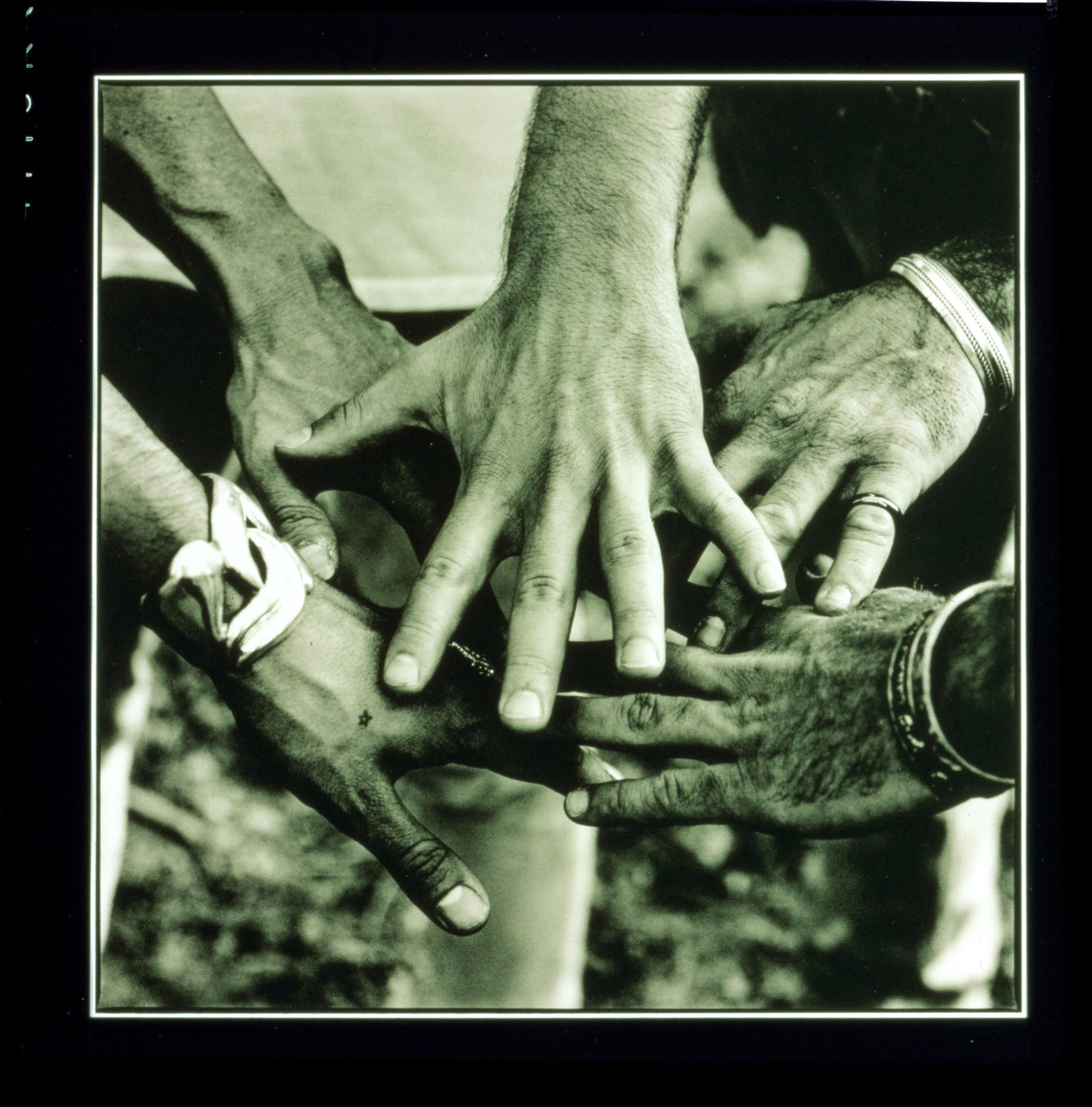 Scattered artefact image