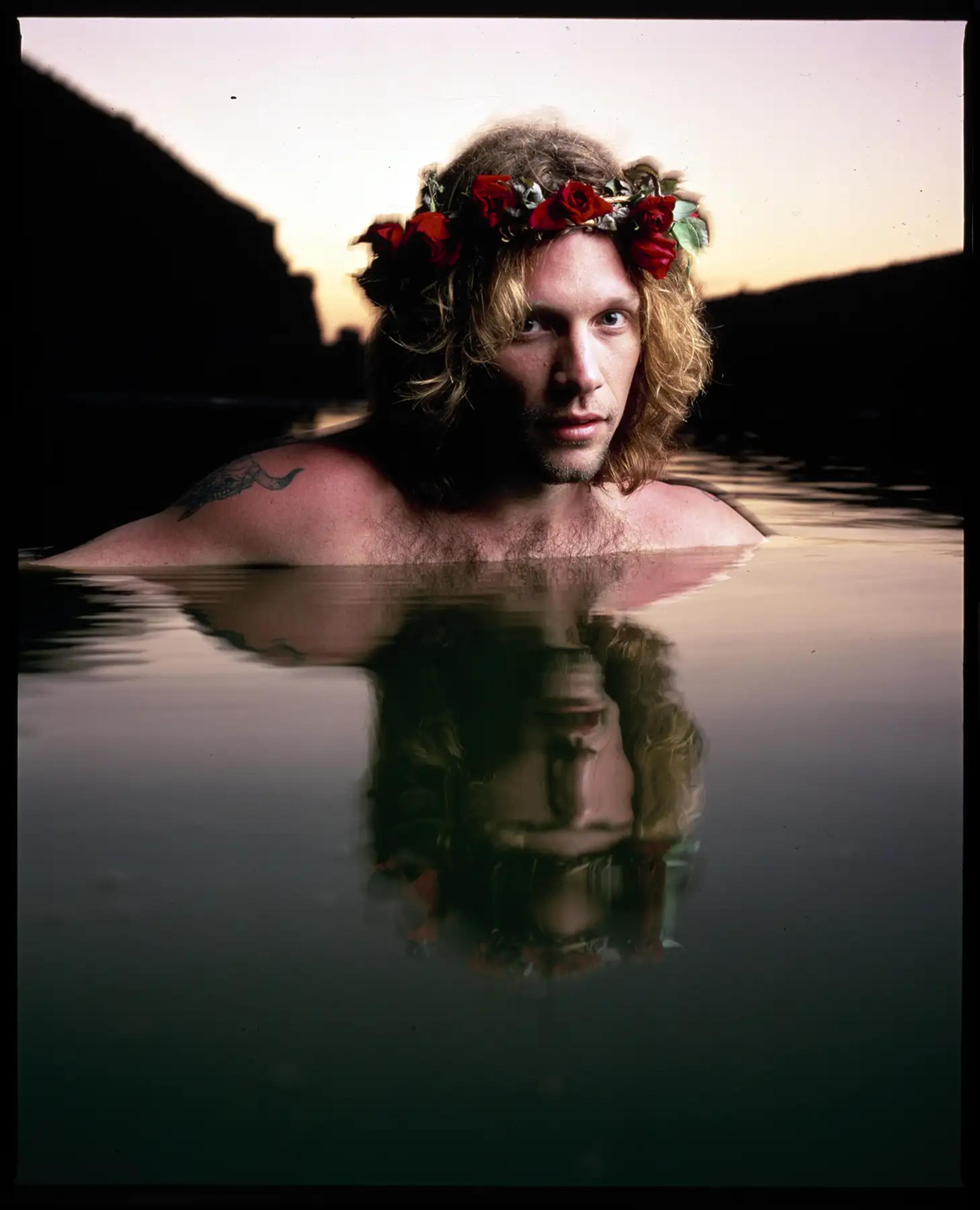 Scattered artefact image