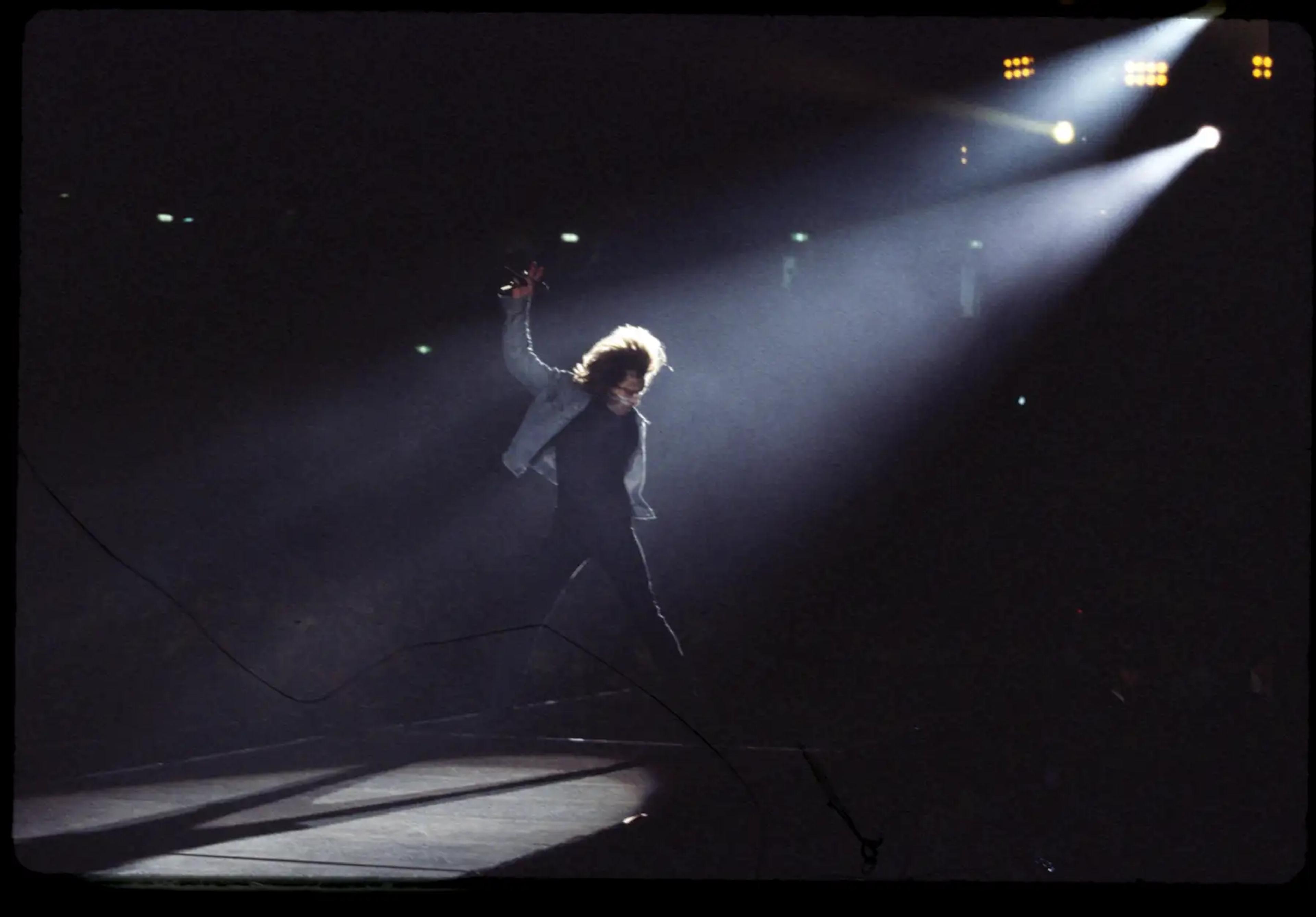 Scattered artefact image