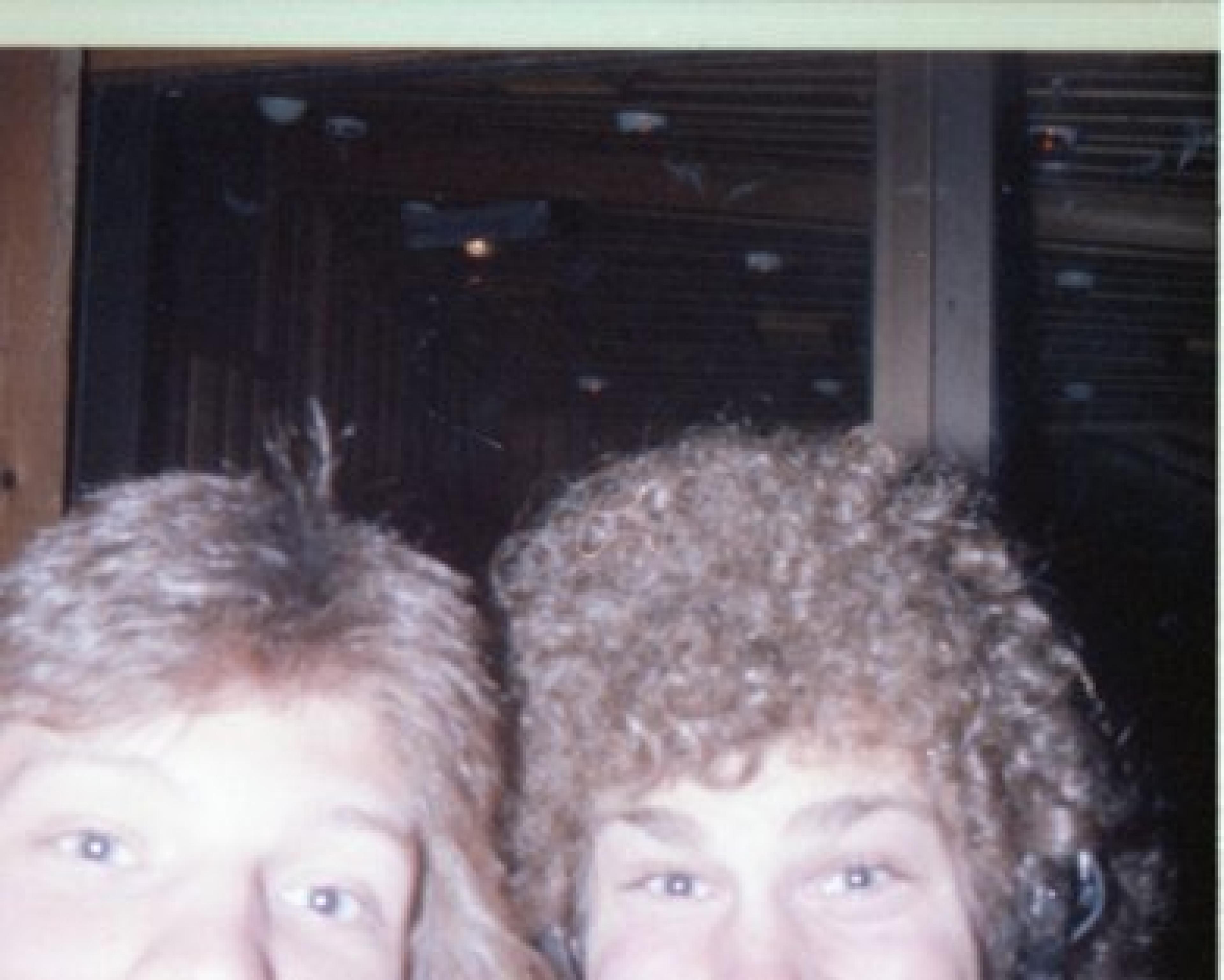 Scattered artefact image