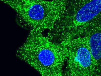 Fluorescence microscopy image for the live condition of CLTA