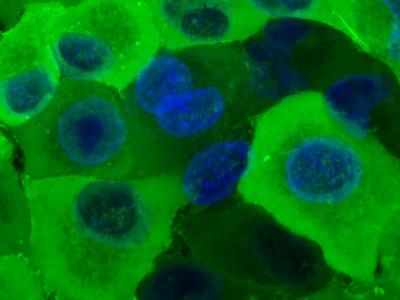 Fluorescence microscopy image for the live condition of ACTB