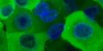 Fluorescence microscopy image for the live condition of ACTB
