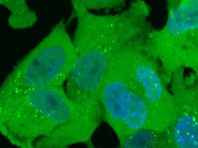 Fluorescence microscopy image for the live condition of EDC4