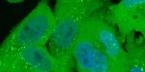 Fluorescence microscopy image for the live condition of EDC4