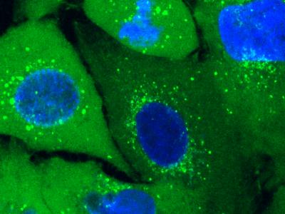Fluorescence microscopy image for the live condition of ATG101