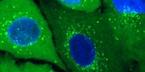 Fluorescence microscopy image for the live condition of ATG101