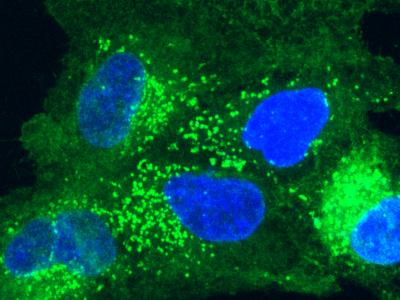 Fluorescence microscopy image for the live condition of ATP1B3