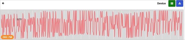 Screenshot of Body Electrical and Waves Overview Screenshot of Body Electrical and Waves Overview