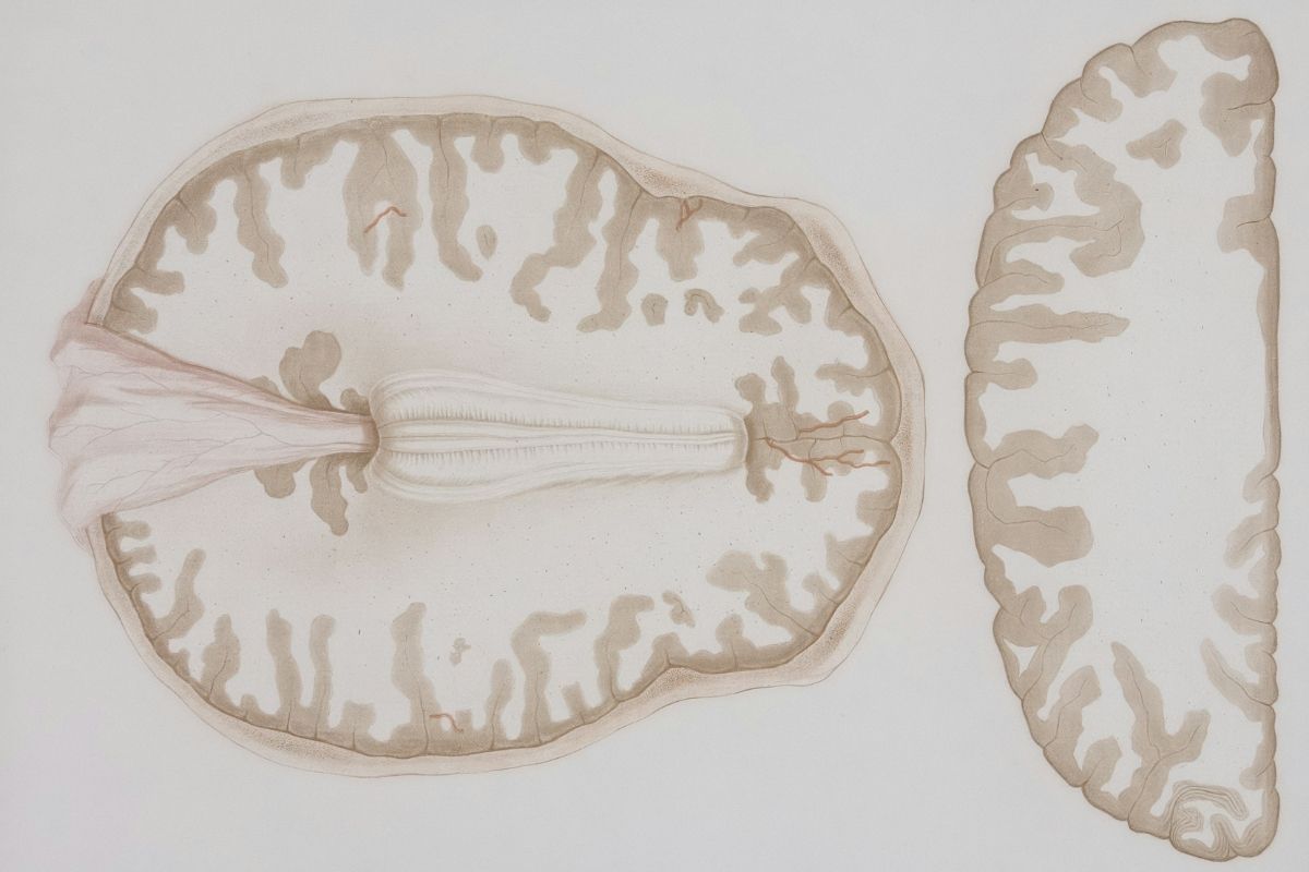 Cover image for Is Artificial Intelligence Human Intelligence?