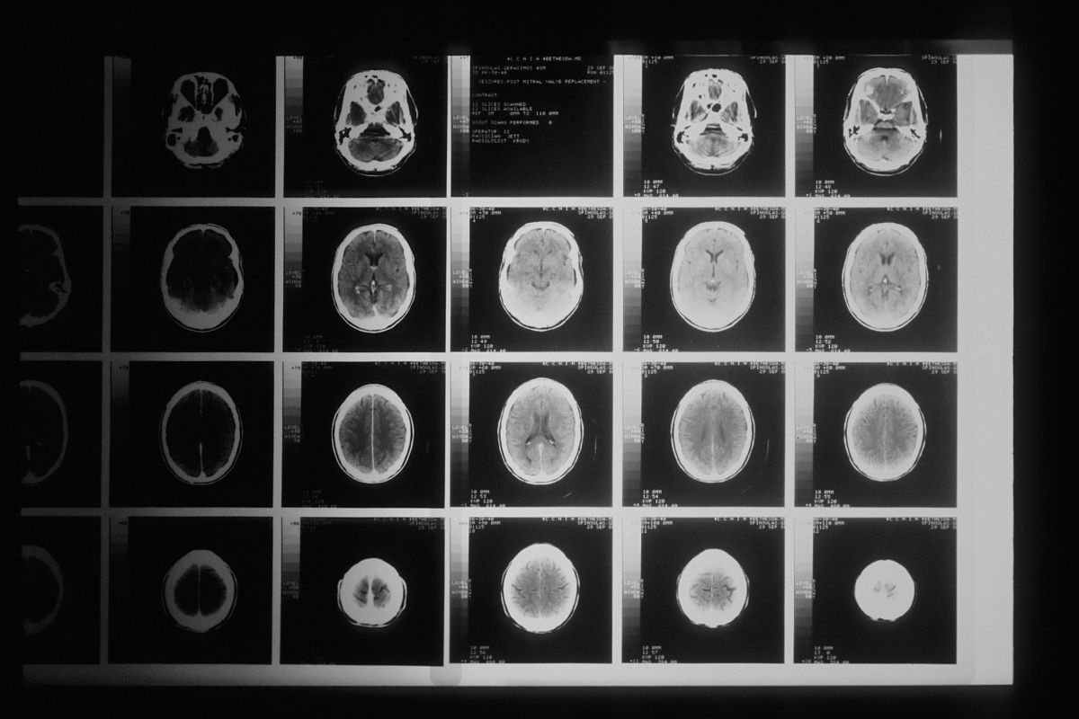 Cover image for Does Neuroscience Disprove Free Will?