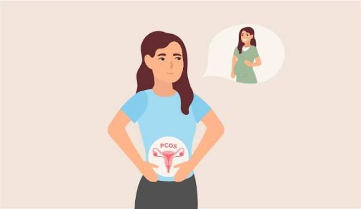 PCOS and Fertility: Can PCOS Make It Difficult to Get Pregnant?
