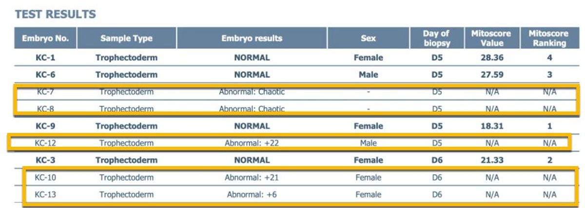 An aneuploid (abnormal) result on a PGT-A report.