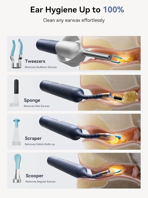 Ear wax removal at home