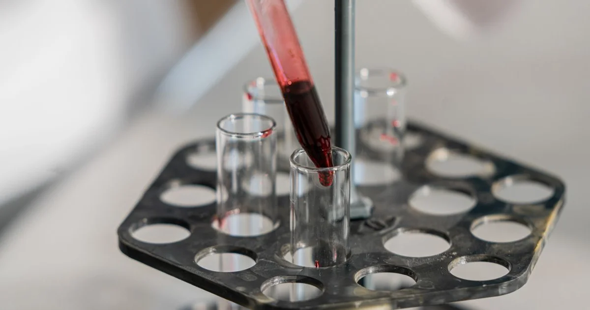 Molybdenum: What This Trace Mineral Does and Which Labs to Watch. Stock photo via Pexels (Ivan S).