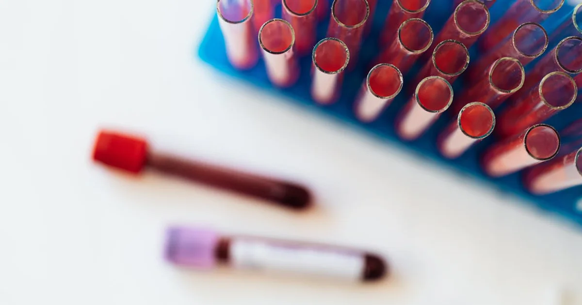 Tesamorelin, IGF-1, and the Labs Worth Tracking. Stock photo via Pexels (www.kaboompics.com).