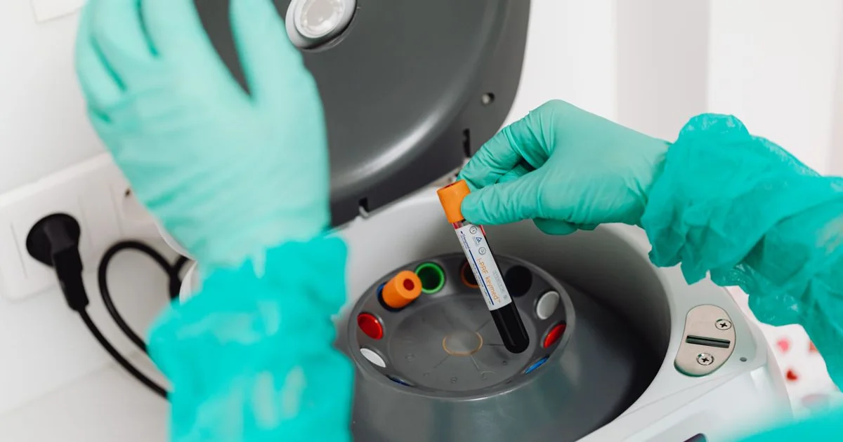Vitamin B5 and Your Labs: What Pantothenic Acid Does in the Body and When to Test. Stock photo via Pexels (www.kaboompics.com).
