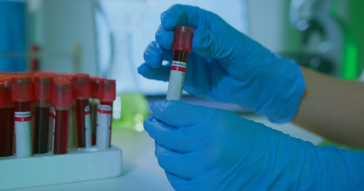 ACE-031: Myostatin Pathway, Muscle Biology, and Labs to Monitor. Stock photo via Pexels (Artem Podrez).