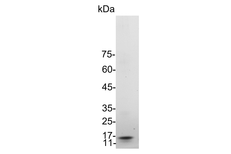 GMP ® IL-2 (Interleukin-2), Human