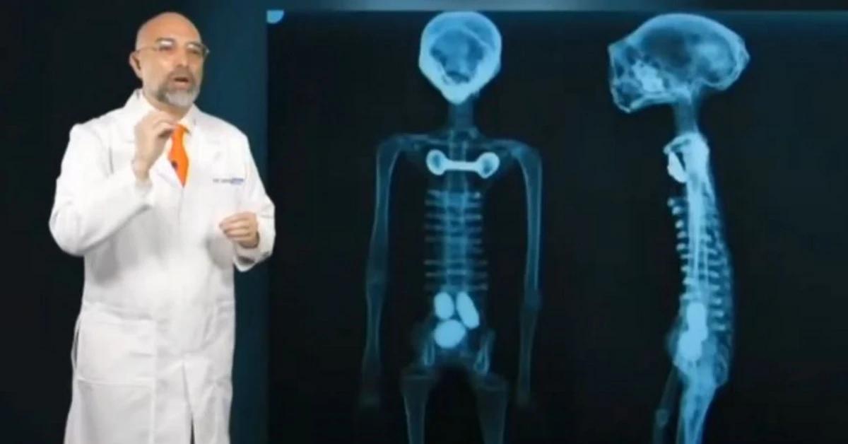 Jaime Maussan presenta nuove mummie di Nazca