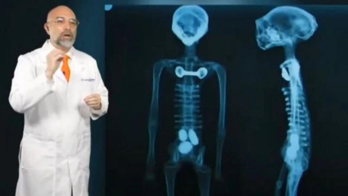 Jaime Maussan presenta nuove mummie di Nazca