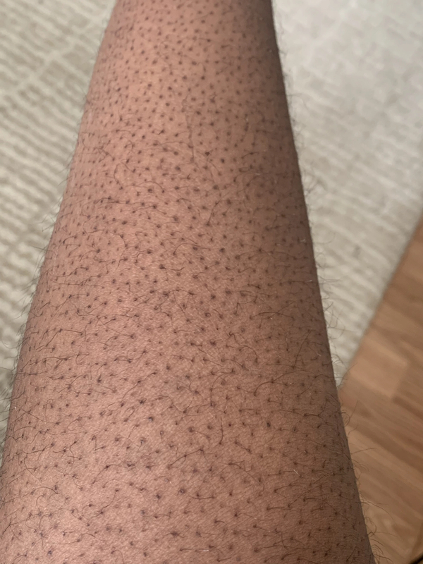 Strawberry Skin Soft Services the body skin experts