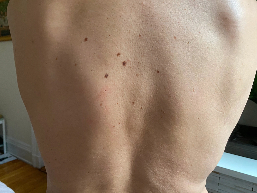 Clogged Pores Soft Services the body skin experts