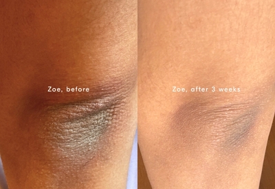 Before and after using Soft Services' Smoothing Solution