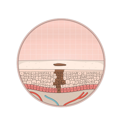 Melanocytes produce melanin, which gives skin its color by releasing melanin granules from the lower layers of the epidermis to the upper layers in cell vehicles called keratinocytes. People with darker skin tones have more active melanocytes than people with lighter skin. Melanocytes can be activated to produce more melanin due to sun exposure, acne, and other stressors, resulting in dark spots.