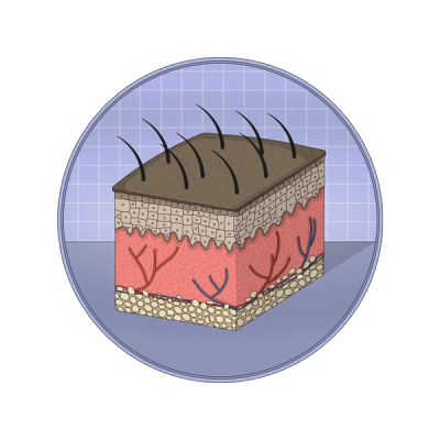 Illustration showing the skin's dermis and epidermis layers.