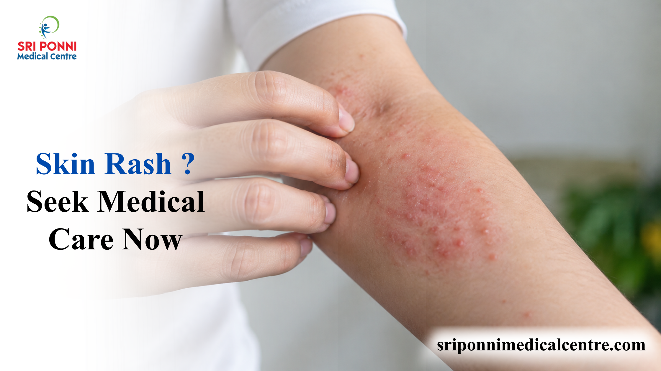 Skin rash causes: symptoms and when to seek medical care