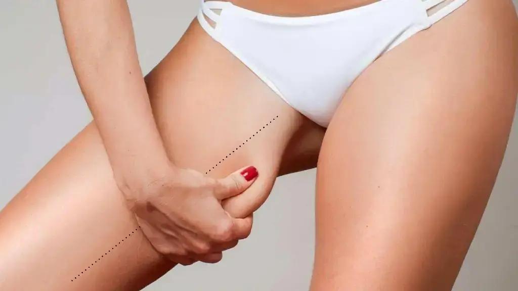 Операция по подтяжке бедра