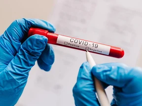 Jenis Virus Covid-19 Baru, XFG Sudah Menyebar Hingga ke 38 Negara