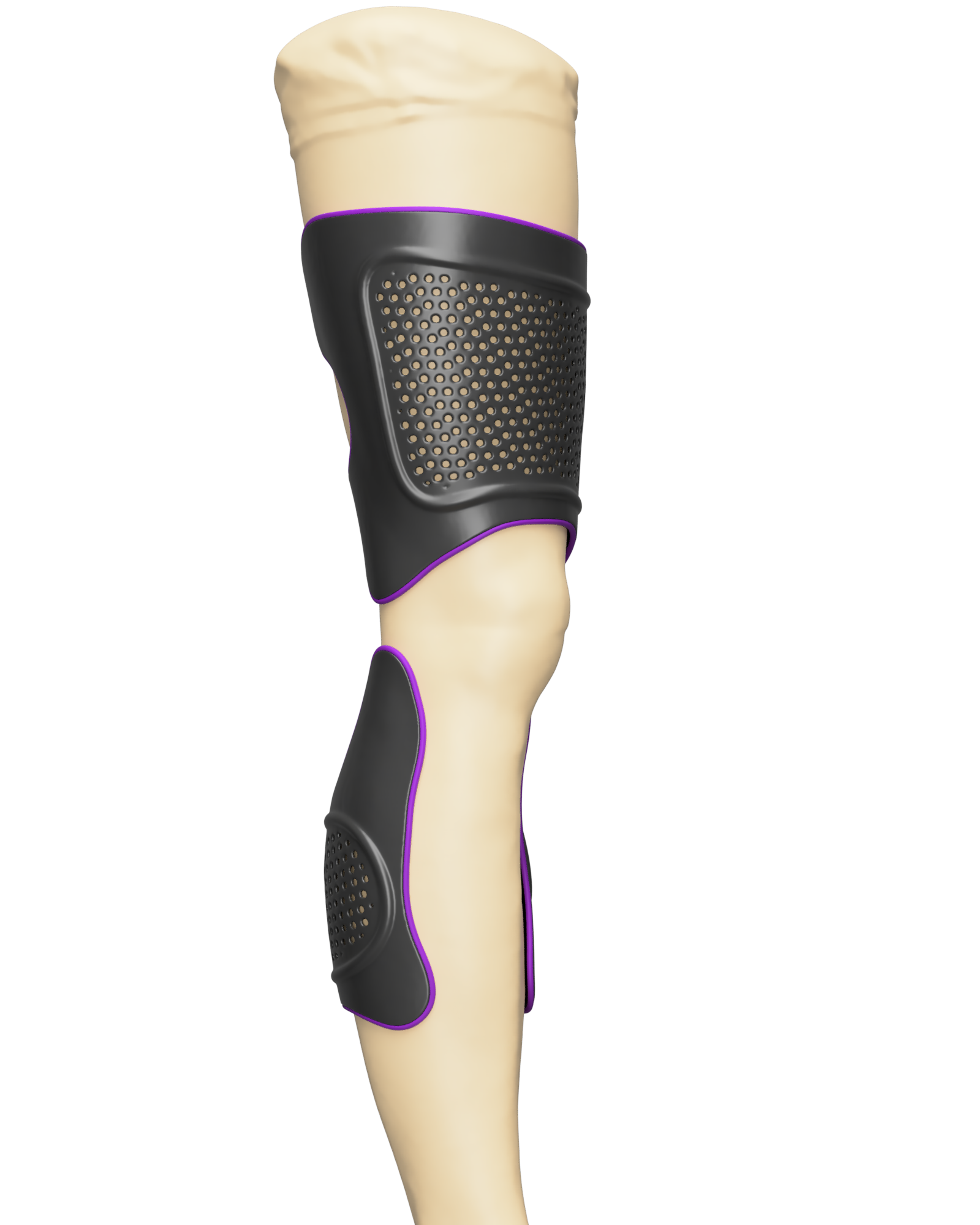 Custom-made knee orthoses