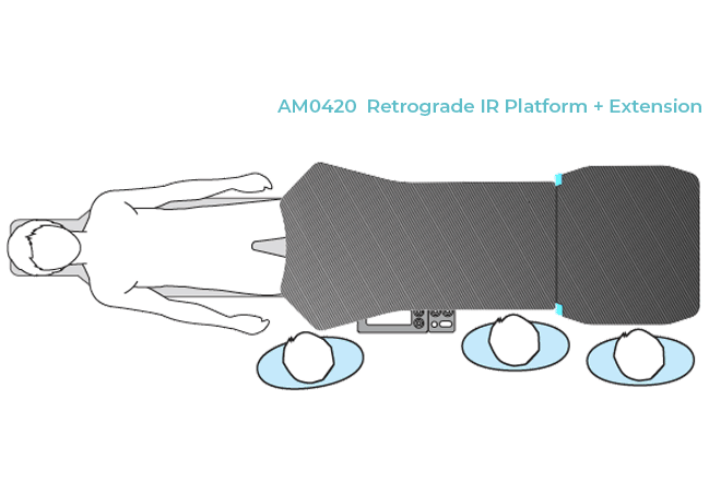 Overhead diagram of a patient on an AM0420 Retrograde IR Platform + Extension, with three staff members.