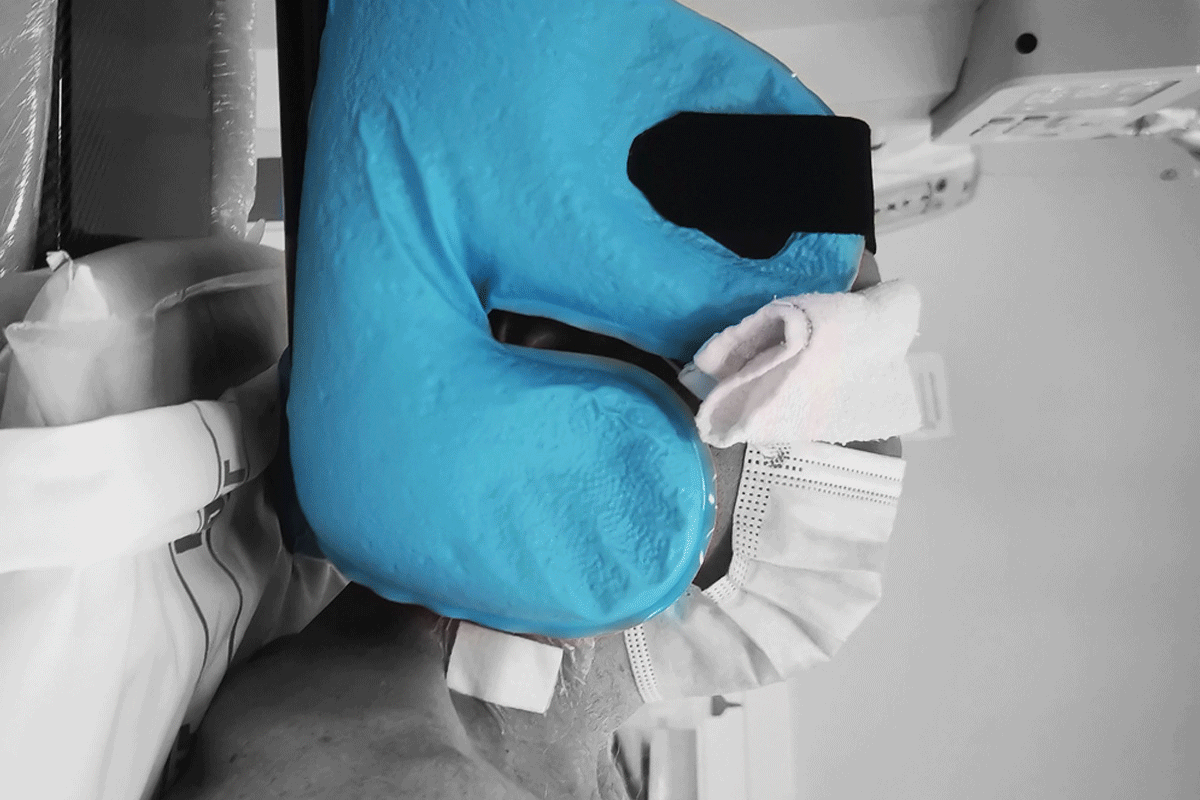 Head Immobilser showing radiolucency