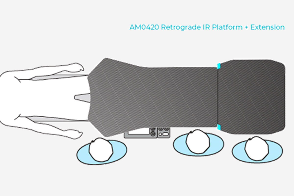 Diagram of AM0420 Retrograde IR Platform + Extension with a patient and three staff members.